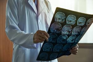 doctor with picture of brain mris